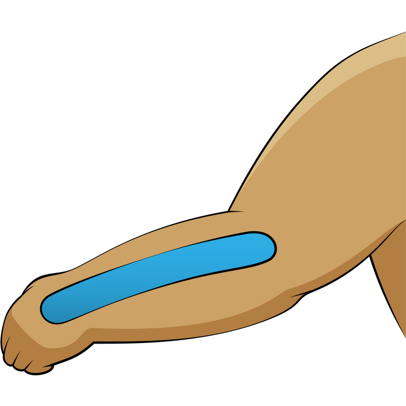 Abschluss und Aktivierung